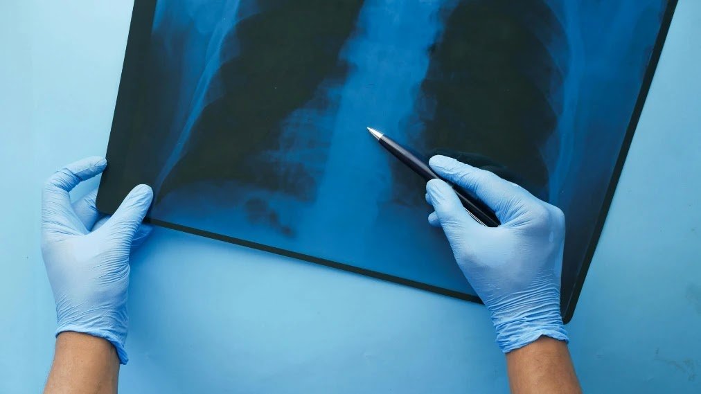 How_Air_and_Water_Pollution_Are_Silently_Destroying_Our_Health_in_India